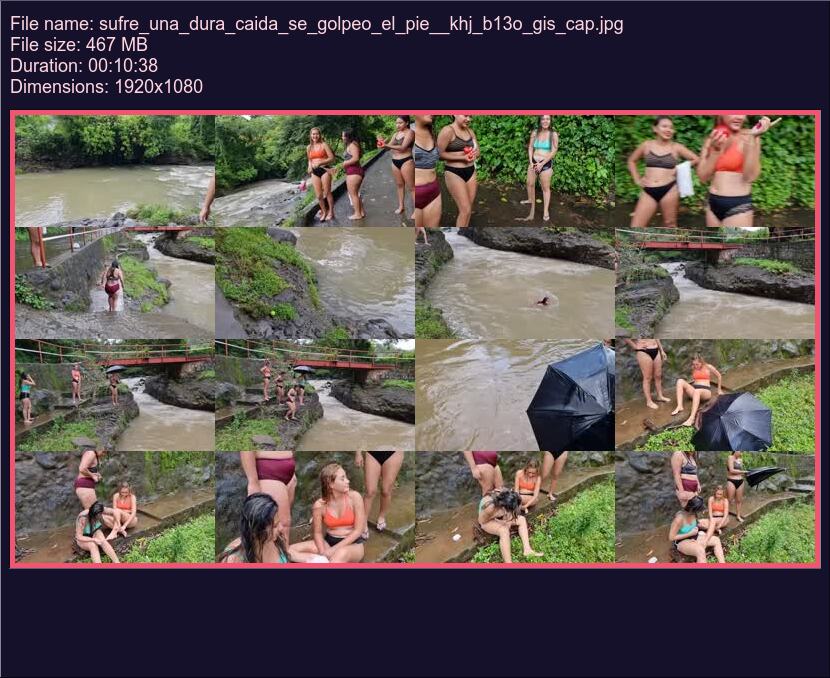 Sufre Una Dura Caida Se Golpeo El Pie Khj B 13 O